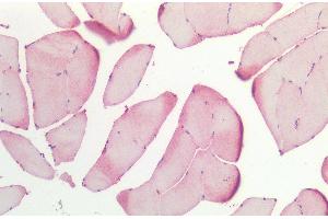 Immunohistochemistry analysis using Rabbit Anti-HSP27 Polyclonal Antibody (ABIN1027725 and ABIN1027726). (HSP27 Antikörper)