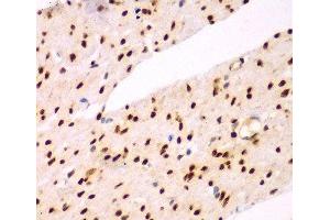 Immunohistochemistry of paraffin-embedded Human colon using TEAD3 Polyclonal Antibody at dilution of 1:100 (40x lens). (TEAD3 Antikörper)