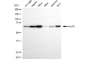 Western blotting analysis using hsp70 antibody (ABIN7798851).