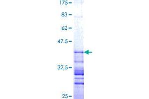 TAB3 Protein (AA 58-149) (GST tag)