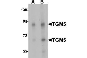 Western blot analysis of TGM5 in rat heart tissue lysate with TGM5 antibody at (A) 1 and (B) 2 µg/mL.