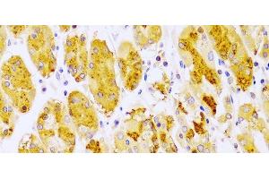 Immunohistochemistry of paraffin-embedded Human stomach using PRKCE Polyclonal Antibody at dilution of 1:100 (40x lens). (PKC epsilon Antikörper)