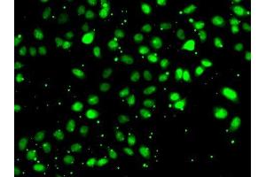 Immunofluorescence analysis of HeLa cells using NUDT2 antibody. (NUDT2 Antikörper  (AA 1-147))