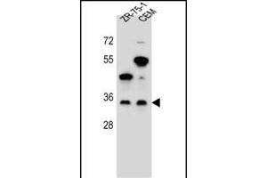 GB Antibody (N-term) (ABIN655821 and ABIN2845245) western blot analysis in ZR-75-1,CEM cell line lysates (35 μg/lane). (GPM6B Antikörper  (N-Term))