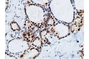 Image no. 19 for anti-EPM2A (Laforin) Interacting Protein 1 (EPM2AIP1) antibody (ABIN1498047) (EPM2AIP1 Antikörper)