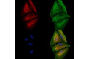 ABIN6257589 and ABIN6273720 staining  cells by IF/ICC. (CANT1 Antikörper  (Internal Region))