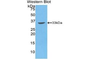 Western blot analysis of the recombinant protein. (PIM2 Antikörper  (AA 34-292))