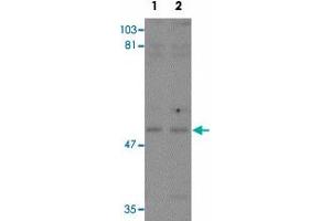 Western blot analysis of KPNA3 in EL4 cell lysate with KPNA3 polyclonal antibody  at (1) 1 and (2) 2 ug/mL. (KPNA3 Antikörper  (C-Term))
