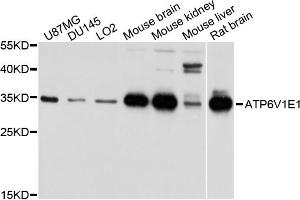 Western blot analysis of extracts of various cell lines, using ATP6V1E1 antibody. (ATP6V1E1 Antikörper)