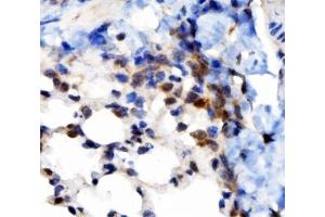 IHC analysis of VAPB using anti-VAPB antibody (ABIN5693292). (VAPB Antikörper  (AA 2-55))