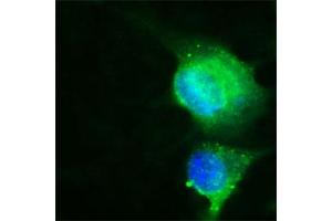 Image no. 5 for anti-CD36 (CD36) (Extracellular Domain) antibody (ABIN350201)