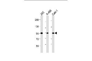 Western Blotting (WB) image for anti-Nephrosis 1, Congenital, Finnish Type (Nephrin) (NPHS1) (AA 1191-1219), (Tyr1210) antibody (ABIN654375)