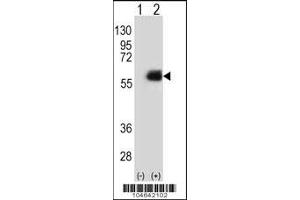 Western blot analysis of NMT2 using rabbit polyclonal NMT2 Antibody (E31) using 293 cell lysates (2 ug/lane) either nontransfected (Lane 1) or transiently transfected (Lane 2) with the NMT2 gene. (NMT2 Antikörper  (N-Term))