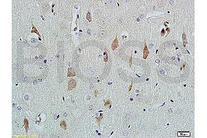 Formalin-fixed and paraffin embedded rat brain tissue labeled with Rabbit Anti-NGF-beta Polyclonal Antibody (ABIN724430) at 1:200 followed by conjugation to the secondary antibody and DAB staining. (NGFB Antikörper  (AA 151-220))