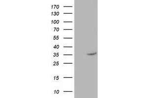 Western Blotting (WB) image for anti-Nudix (Nucleoside Diphosphate Linked Moiety X)-Type Motif 6 (NUDT6) antibody (ABIN1499868) (NUDT6 Antikörper)