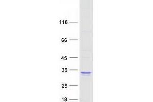 Western Blotting (WB) image for Src-like-adaptor 2 (SLA2) (Transcript Variant 1) protein (Myc-DYKDDDDK Tag) (ABIN2732140)