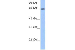 WB Suggested Anti-ZNF837 Antibody Titration:  0. (ZNF837 Antikörper  (N-Term))