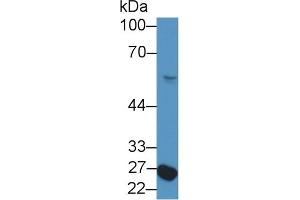 Detection of NFIX in Rat Serum using Polyclonal Antibody to Nuclear Factor I/X (NFIX) (NFIX Antikörper  (AA 13-298))