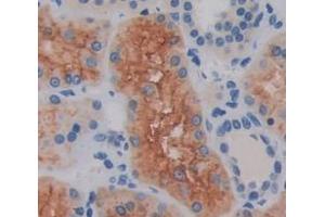 Used in DAB staining on fromalin fixed paraffin- embedded Kidney tissue (SLFN5 Antikörper  (AA 658-891))