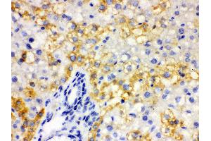 Anti- ALDH2 Picoband antibody, IHC(P) IHC(P): Rat Liver Tissue