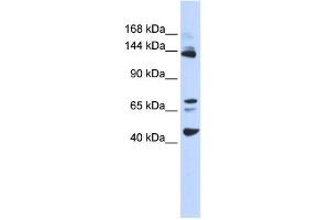 WB Suggested Anti-BRD8 Antibody Titration:  0. (BRD8 Antikörper  (Middle Region))