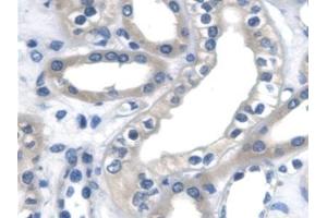 Immunohistochemistry (IHC) image for anti-Catenin, beta (CATNB) (AA 439-675) antibody (ABIN7433027)