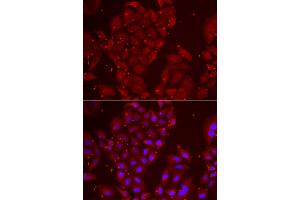 Immunofluorescence analysis of U2OS cells using TPP2 antibody.
