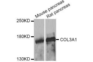 Western blot analysis of extracts of various cell lines, using COL3A1 antibody. (COL3A1 Antikörper  (AA 1217-1466))