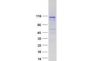 Western Blotting (WB) image for Inositol Polyphosphate-4-Phosphatase, Type I, 107kDa (INPP4A) (Transcript Variant A) protein (Myc-DYKDDDDK Tag) (ABIN2723479)
