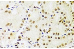 Immunohistochemistry of paraffin-embedded Human stomach using PRPF3 Polyclonal Antibody at dilution of 1:100 (40x lens).