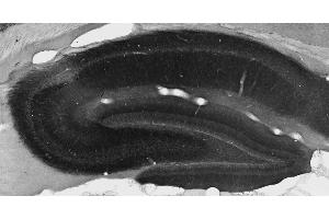 Adult rat hippocampal immunohistochemistry. (KCNT2 Antikörper  (AA 564-624))