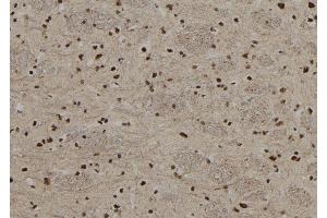 ABIN6267208 at 1/100 staining Rat brain tissue by IHC-P. (MECP2 Antikörper  (pSer80))