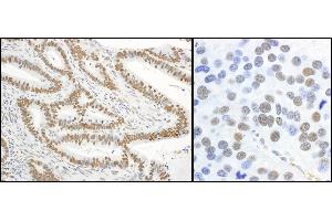 Immunohistochemistry (IHC) image for anti-X-Ray Repair Complementing Defective Repair in Chinese Hamster Cells 1 (XRCC1) (pSer485), (pThr488) antibody (ABIN7449375)