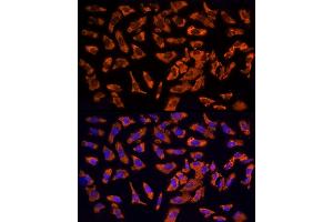 Immunofluorescence analysis of U2OS cells using EPS15 Rabbit pAb  at dilution of 1:200 (40x lens). (EPS15 Antikörper  (AA 660-840))
