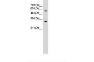Image no. 2 for anti-Solute Carrier Family 22 (Organic Cation Transporter), Member 1 (SLC22A1) (C-Term) antibody (ABIN203397) (SLC22A1 Antikörper  (C-Term))