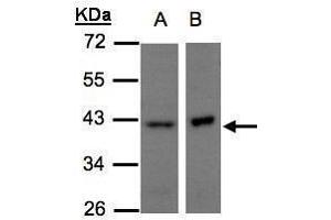 WB Image Sample(30 μg of whole cell lysate) A:H1299 B:Raji, 10% SDS PAGE antibody diluted at 1:500 (NDUFA10 Antikörper  (Center))
