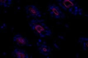 Immunofluorescent analysis of paraformaldehyde-fixed mouse skin using,alpha Actinin (ABIN7073023) at dilution of 1: 500