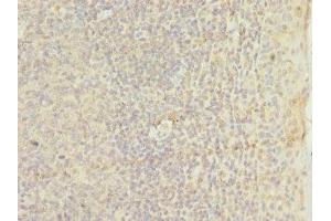 Immunohistochemistry of paraffin-embedded human tonsil tissue using ABIN7172948 at dilution of 1:100 (TM9SF3 Antikörper  (AA 133-300))