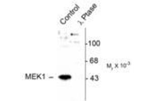 Image no. 1 for anti-Mitogen-Activated Protein Kinase Kinase 1 (MAP2K1) (pThr386) antibody (ABIN221148) (MEK1 Antikörper  (pThr386))