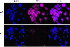 Immunocytochemical staining of HeLa cells using CDK4 antibody (ABIN7798214), 1:1,000), Top panel: wild-type (WT), Bottom panal: CDK4 shRNA knockdown (KD). (Rekombinanter CDK4 Antikörper)