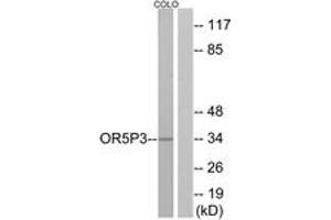 Western blot analysis of extracts from COLO cells, using OR5P3 Antibody. (OR5P3 Antikörper  (AA 55-104))