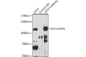 Immunoprecipitation analysis of 200 μg extracts of HT-29 cells, using 3 μg EZH2/KMT6 antibody (ABIN6133510, ABIN6140394, ABIN6140397 and ABIN6218016). (EZH2 Antikörper  (AA 50-150))