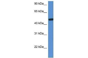 Western Blot showing HEXA antibody used at a concentration of 1 ug/ml against Fetal Kidney Lysate (Hexosaminidase A Antikörper  (C-Term))