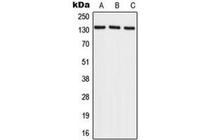 Western blot analysis of RECQL4 expression in HeLa (A), NIH3T3 (B), rat brain (C) whole cell lysates. (RECQL4 Antikörper  (C-Term))