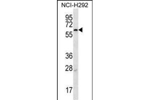 MBTPS2 Antibody (N-term) (ABIN656896 and ABIN2846095) western blot analysis in NCI- cell line lysates (35 μg/lane).