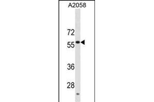 USP14 Antibody (C-term) (ABIN1881985 and ABIN2838857) western blot analysis in  cell line lysates (35 μg/lane). (USP14 Antikörper  (C-Term))