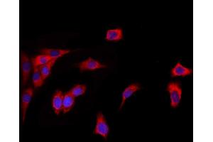 ABIN6260454 and ABIN6272856 staining HepG2 by IF/ICC.