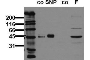 Western Blotting (WB) image for anti-Vasodilator-Stimulated phosphoprotein (VASP) (pSer239) antibody (ABIN126913) (VASP Antikörper  (pSer239))