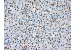 Immunohistochemical staining of paraffin-embedded colon tissue using anti-BSG mouse monoclonal antibody. (CD147 Antikörper)