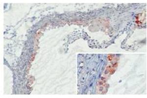 Image no. 1 for anti-Mannose-Binding Lectin (Protein C) 2, Soluble (MBL2) antibody (ABIN959720)